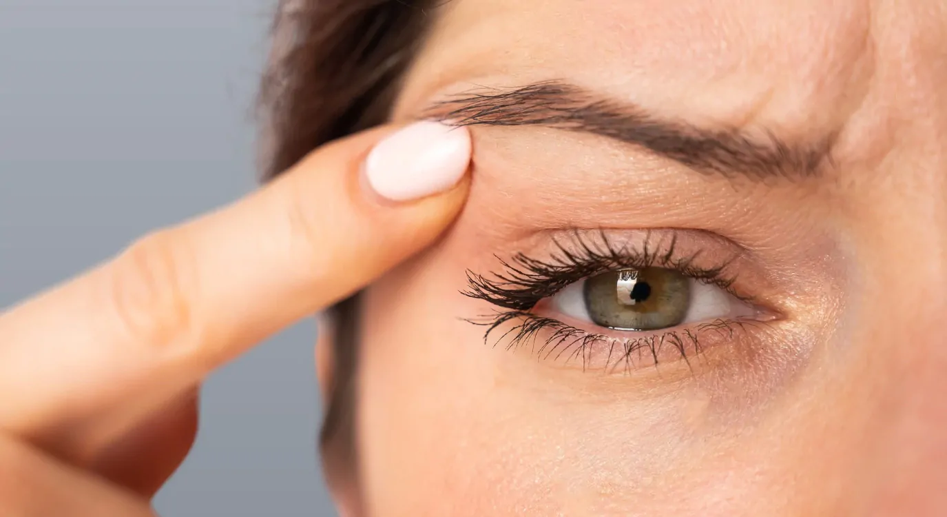 Blefaroplastia