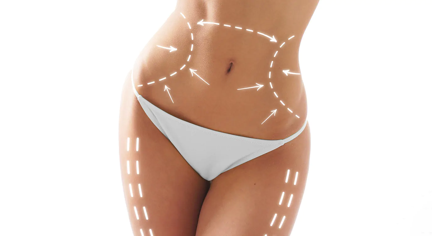 Lipoaspiração e Lipoescultura